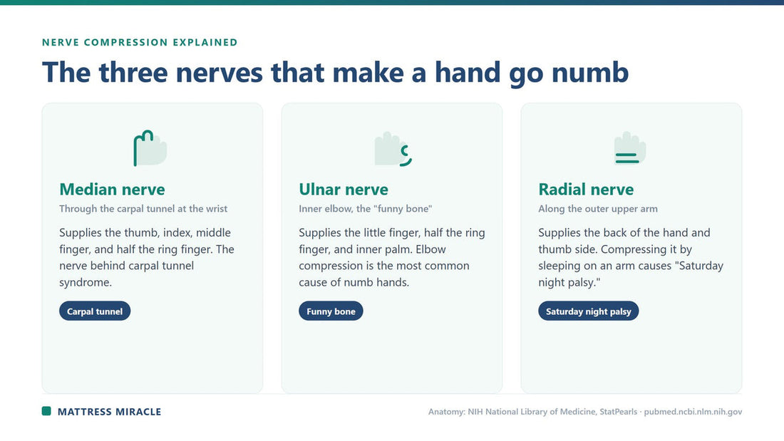 Diagram of the median, ulnar, and radial nerves that cause hand numbness - Mattress Miracle Brantford